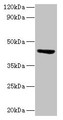 Western blot; All lanes: ST3GAL3 antibody at 2µg/ml + Mouse skeletal muscle tissue; Secondary; Goat polyclonal to rabbit lgG at 1/15000 dilution; Predicted band size: 43, 44, 20, 50, 39, 22, 32, 13, 21, 14, 18, 49, 17, 41, 31, 16, 47, 26, 27, 12, 23, 6, 9 kDa; Observed band size: 43 kDa