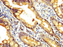 IHC image diluted at 1:400 and staining in paraffin-embedded human small intestine tissue performed on a Leica BondTM system. After dewaxing and hydration, antigen retrieval was mediated by high pressure in a citrate buffer (pH 6.0). Section was blocked with 10% normal goat serum 30min at RT. Then primary antibody (1% BSA) was incubated at 4°C overnight. The primary is detected by a biotinylated secondary antibody and visualized using an HRP conjugated SP system.