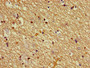 Immunohistochemistry of paraffin-embedded human brain tissue using CAC09267 at dilution of 1:100