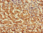 Immunohistochemistry of paraffin-embedded human liver cancer using CAC09296 at dilution of 1:100