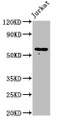 Western Blot; Positive WB detected in: Jurkat whole cell lysate; All lanes: IL18R1 antibody at 2µg/ml; Secondary; Goat polyclonal to rabbit IgG at 1/50000 dilution; Predicted band size: 63 kDa; Observed band size: 63 kDa