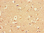 Immunohistochemistry of paraffin-embedded human brain tissue using CAC09319 at dilution of 1:100