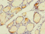 Immunohistochemistry of paraffin-embedded human thyroid tissue using CAC09322 at dilution of 1:100