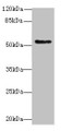 Western blot; All lanes: PLEKHS1 antibody at 1.5µg/ml + MDA-MB-231 whole cell lysate; Secondary; Goat polyclonal to rabbit IgG at 1/10000 dilution; Predicted band size: 52, 51, 41, 53 kDa; Observed band size: 52 kDa