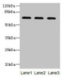 Western blot; All lanes: SCARA3 antibody at 0.8µg/ml; Lane 1: Mouse liver tissue; Lane 2: Mouse kidney tissue; Lane 3: A549 whole cell lysate; Secondary; Goat polyclonal to rabbit IgG at 1/10000 dilution; Predicted band size: 66, 53 kDa; Observed band size: 66 kDa