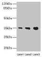 Western blot; All lanes: PVRIG antibody at 4µg/ml; Lane 1: Mouse liver tissue; Lane 2: Mouse kidney tissue; Lane 3: Mouse heart tissue; Secondary; Goat polyclonal to rabbit IgG at 1/10000 dilution; Predicted band size: 35 kDa; Observed band size: 35 kDa