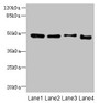 Western blot; All lanes: DDI2 antibody at 4µg/ml; Lane 1: A431 whole cell lysate; Lane 2: HL60 whole cell lysate; Lane 3: K562 whole cell lysate; Lane 4: Caco-2 whole cell lysate; Secondary; Goat polyclonal to rabbit IgG at 1/10000 dilution; Predicted band size: 45, 24, 47 kDa; Observed band size: 47 kDa