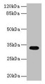 Western blot; All lanes: CYB5R2 antibody at 4µg/ml + Mouse kidney tissue; Secondary; Goat polyclonal to rabbit IgG at 1/10000 dilution; Predicted band size: 32, 28 kDa; Observed band size: 32 kDa