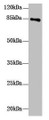 Western Blot; All lanes: DHX32 antibody at 10µg/ml + Mouse liver tissue; Secondary; Goat polyclonal to rabbit IgG at 1/10000 dilution; Predicted band size: 85, 76 kDa; Observed band size: 85 kDa