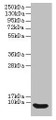 Western blot; All lanes: Defb14 antibody at 12µg/ml + Rat liver tissue; Secondary; Goat polyclonal to rabbit IgG at 1/10000 dilution; Predicted band size: 8 kDa; Observed band size: 8 kDa