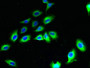 Immunofluorescent analysis of A549 cells using CAC09407 at dilution of 1:100 and Alexa Fluor 488-congugated AffiniPure Goat Anti-Rabbit IgG(H+L)