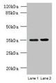 Western blot; All lanes: CFAP65 antibody at 8µg/ml; Lane 1: U251 whole cell lysate; Lane 2: U87 whole cell lysate; Secondary; Goat polyclonal to rabbit IgG at 1/10000 dilution; Predicted band size: 218, 19, 82, 88 kDa; Observed band size: 35 kDa