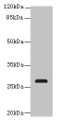 Western blot; All lanes: C17orf64 antibody at 4µg/ml + Mouse gonadal tissue; Secondary; Goat polyclonal to rabbit IgG at 1/10000 dilution; Predicted band size: 28 kDa; Observed band size: 28 kDa