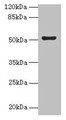 Western blot; All lanes: SLC46A3 antibody at 4µg/ml + Jurkat whole cell lysate; Secondary; Goat polyclonal to rabbit IgG at 1/10000 dilution; Predicted band size: 52, 43 kDa; Observed band size: 52 kDa