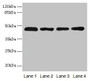 Western blot; All lanes: ZDHHC23 antibody at 8µg/ml; Lane 1: 293T whole cell lysate; Lane 2: Mouse brain tissue; Lane 3: A549 whole cell lysate; Lane 4: Human placenta tissue; Secondary; Goat polyclonal to rabbit IgG at 1/10000 dilution; Predicted band size: 46 kDa; Observed band size: 46 kDa
