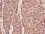 Immunohistochemistry of paraffin-embedded human ovarian cancer using CAC09520 at dilution of 1:100