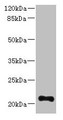 Western blot; All lanes: TTC9C antibody at 12µg/ml + THP-1 whole cell lysate; Secondary; Goat polyclonal to rabbit IgG at 1/10000 dilution; Predicted band size: 21, 25 kDa; Observed band size: 21 kDa