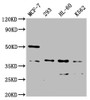 Western Blot; Positive WB detected in: MCF-7 whole cell lysate, 293 whole cell lysate, HL60 whole cell lysate, K562 whole cell lysate; All lanes: MRGPRX2 antibody at 1:2000; Secondary; Goat polyclonal to rabbit IgG at 1/50000 dilution; Predicted band size: 38 kDa; Observed band size: 38 kDa;