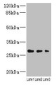 Western blot; All lanes: LRRC57 antibody at 4µg/ml; Lane 1: Mouse liver tissue; Lane 2: Mouse kidney tissue; Lane 3: Mouse lung tissue; Secondary; Goat polyclonal to rabbit IgG at 1/10000 dilution; Predicted band size: 27 kDa; Observed band size: 27 kDa