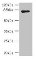 Western blot; All lanes: FBXO30 antibody at 10µg/ml + Mouse brain tissue; Secondary; Goat polyclonal to rabbit IgG at 1/10000 dilution; Predicted band size: 83 kDa; Observed band size: 83 kDa