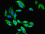 Immunofluorescent analysis of Hela cells using CAC09597 at dilution of 1:100 and Alexa Fluor 488-congugated AffiniPure Goat Anti-Rabbit IgG(H+L)