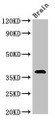 Western Blot; Positive WB detected in: Mouse brain tissue; All lanes: NEUROD6 antibody at 3µg/ml; Secondary; Goat polyclonal to rabbit IgG at 1/50000 dilution; Predicted band size: 39 kDa; Observed band size: 39 kDa;