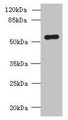 Western blot; All lanes: SLC38A2 antibody at 1.5µg/ml + A431 whole cell lysate; Secondary; Goat polyclonal to rabbit IgG at 1/10000 dilution; Predicted band size: 57, 46 kDa; Observed band size: 57 kDa