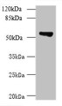 Western blot; All lanes: TCP11L2 antibody at 1µg/ml + A549 whole cell lysate; Secondary; Goat polyclonal to rabbit at 1/10000 dilution; Predicted band size: 59, 30 kDa; Observed band size: 59 kDa