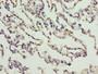 Immunohistochemistry of paraffin-embedded human lung tissue using CAC09617 at dilution of 1:100