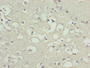 Immunohistochemistry of paraffin-embedded human brain tissue using CAC09617 at dilution of 1:100