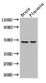 Western Blot; Positive WB detected in: Mouse brain tissue, Human placenta tissue; All lanes: CD177 antibody at 3µg/ml; Secondary; Goat polyclonal to rabbit IgG at 1/50000 dilution; Predicted band size: 47, 28, 16 kDa; Observed band size: 47 kDa;