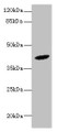 Western blot; All lanes: HM13 antibody at 6µg/ml + Mouse liver tissue; Secondary; Goat polyclonal to rabbit at 1/10000 dilution; Predicted band size: 42, 47, 44, 37 kDa; Observed band size: 42 kDa;