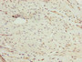 Immunohistochemistry of paraffin-embedded human bladder cancer using CAC09644 at dilution of 1:100