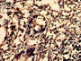 IHC image diluted at 1:600 and staining in paraffin-embedded human appendix tissue performed on a Leica BondTM system. After dewaxing and hydration, antigen retrieval was mediated by high pressure in a citrate buffer (pH 6.0). Section was blocked with 10% normal goat serum 30min at RT. Then primary antibody (1% BSA) was incubated at 4°C overnight. The primary is detected by a biotinylated secondary antibody and visualized using an HRP conjugated SP system.