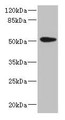 Western blot; All lanes: KRT35 antibody at 4µg/ml + PC-3 whole cell lysate; Secondary; Goat polyclonal to rabbit IgG at 1/10000 dilution; Predicted band size: 51 kDa; Observed band size: 51 kDa