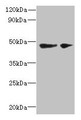 Western blot; All lanes: SLC25A46 antibody at 6µg/ml; Lane 1: Mouse brain tissue; Lane 2: Jurkat whole cell lysate; Secondary; Goat polyclonal to rabbit IgG at 1/10000 dilution; Predicted band size: 47, 31, 38 kDa; Observed band size: 47 kDa
