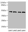 Western blot; All lanes: NOL4L antibody at 0.3µg/ml; Lane 1: PC-3 whole cell lysate; Lane 2: A549 whole cell lysate; Lane 3: HepG2 whole cell lysate; Lane 4: K562 whole cell lysate; Secondary; Goat polyclonal to rabbit IgG at 1/10000 dilution; Predicted band size: 48, 44 kDa; Observed band size: 48 kDa