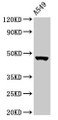 Western Blot; , Positive WB detected in: A549 whole cell lysate; , All lanes: NOL4L antibody at 3µg/ml; , Secondary; , Goat polyclonal to rabbit IgG at 1/50000 dilution; , Predicted band size: 48, 44 kDa; , Observed band size: 48 kDa