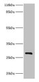 Western blot; All lanes: HSD17B14 antibody at 2µg/ml + Mouse kidney tissue; Secondary; Goat polyclonal to rabbit IgG at 1/10000 dilution; Predicted band size: 29 kDa; Observed band size: 29 kDa
