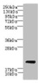 Western blot; All lanes: CYBC1 antibody at 1.5µg/ml + Mouse liver tissue; Secondary; Goat polyclonal to rabbit IgG at 1/10000 dilution; Predicted band size: 21, 20 kDa; Observed band size: 21 kDa