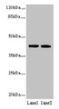 Western blot; All lanes: SDF4 antibody at 6µg/ml; Lane 1: U87 whole cell lysate; Lane 2: Jurkat whole cell lysate; Secondary; Goat polyclonal to rabbit IgG at 1/10000 dilution; Predicted band size: 42, 31, 28, 24, 16, 40 kDa; Observed band size: 42 kDa