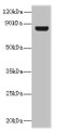 Western blot; All lanes: TSGA10 antibody at 1.5µg/ml + U251 whole cell lysate; Secondary; Goat polyclonal to rabbit IgG at 1/10000 dilution; Predicted band size: 82, 35 kDa; Observed band size: 82 kDa