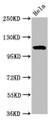 Western Blot; , Positive WB detected in: Hela whole cell lysate; , All lanes:NAT10 antibody at 7µg/ml; , Secondary; , Goat polyclonal to rabbit IgG at 1/50000 dilution; , Predicted band size: 116, 108 kDa; , Observed band size: 116 kDa;