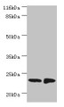 Western blot; All lanes: C7orf50 antibody at 2µg/ml; Lane 1: A549 whole cell lysate; Lane 2: MCF-7 whole cell lysate; Secondary; Goat polyclonal to rabbit IgG at 1/10000 dilution; Predicted band size: 23 kDa; Observed band size: 23 kDa