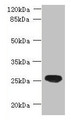 Western blot; All lanes: ENKD1 antibody at 7µg/ml + Mouse brain tissue; Secondary; Goat polyclonal to rabbit IgG at 1/10000 dilution; Predicted band size: 39, 26 kDa; Observed band size: 26 kDa