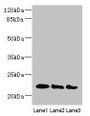 Western blot; All lanes: ARL8B antibody at 4µg/ml; Lane 1: Mouse brain tissue; Lane 2: NIH/3T3 whole cell lysate; Lane 3: Jurkat whole cell lysate; Secondary; Goat polyclonal to rabbit IgG at 1/10000 dilution; Predicted band size: 22, 19 kDa; Observed band size: 22 kDa