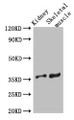 Western Blot; Positive WB detected in: Mouse kidney tissue, Mouse skeletal muscle tissue; All lanes: SLC25A32 antibody at 3µg/ml; Secondary; Goat polyclonal to rabbit IgG at 1/50000 dilution; Predicted band size: 36 kDa; Observed band size: 36 kDa