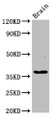 Western Blot; Positive WB detected in: Rat brain tissue; All lanes: GHITM antibody at 2.7µg/ml; Secondary; Goat polyclonal to rabbit IgG at 1/50000 dilution; Predicted band size: 38 kDa; Observed band size: 38 kDa