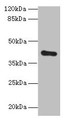 Western blot; All lanes: ZDHHC4 antibody at 1.5µg/ml + Mouse liver tissue; Secondary; Goat polyclonal to rabbit IgG at 1/10000 dilution; Predicted band size: 40 kDa; Observed band size: 40 kDa
