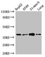 Western Blot; Positive WB detected in: HepG2 whole cell lysate, A549 whole cell lysate, Mouse stomach tissue, Mouse lung tissue; All lanes: PARD6A antibody at 2.5µg/ml; Secondary; Goat polyclonal to rabbit IgG at 1/50000 dilution; Predicted band size: 38 kDa; Observed band size: 38 kDa